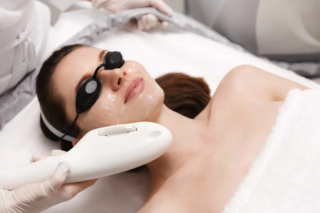 PhotoFacial what are the benefits of ipl photofacial 1024x683